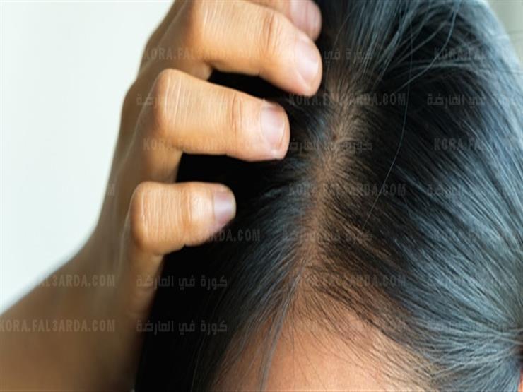 مكون معجزة لتطويل وإنبات فراغات الشعر ومعالجة الصلع ومنع التساقط خلال 7 أيام فقط| طريقة التحضير