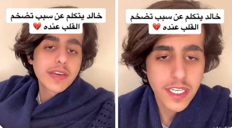 شاهد.. شاب يكشف عن إصابته بتضخم في القلب بسبب مشروب شهير.. ويوضح الكمية التي تناولها
