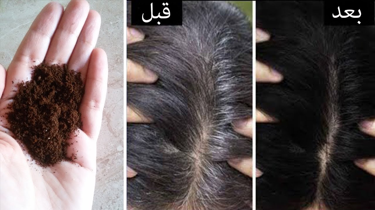 القهوة لإزالة الشعر الأبيض