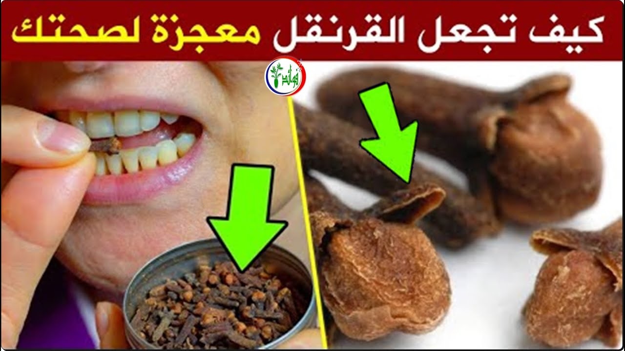 القرنفل تحت اللسان