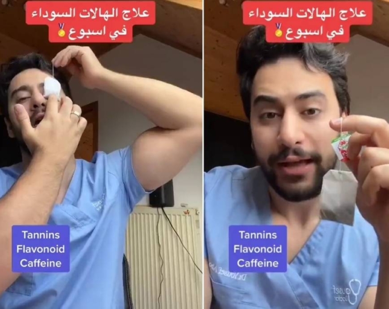 أفضل طريقة لإزالة الهالات السوداء أسفل العين باستخدام هذا المشروب السحري!