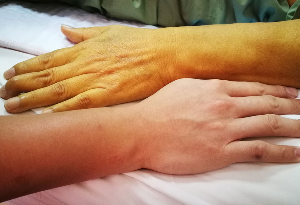 تعرف عليها الأن ..  ظهور 9 أعراض وعلامات على جسمك تدل دلالة قاطعة على نقص فيتامين (ب12) ؟