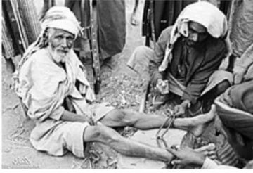 شاهد صورة من تاريخ ثورة 26 سبتمبر لشيخ مناضل من مأرب وقيود الإمام أحمد حميدالدين على قدميه