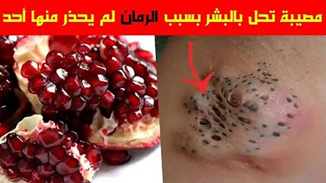 لا تتناول فاكهة الرمان :  بهذه الطريقة تتحول الى سم قاتل ومصيبة تقرب من أجلك !