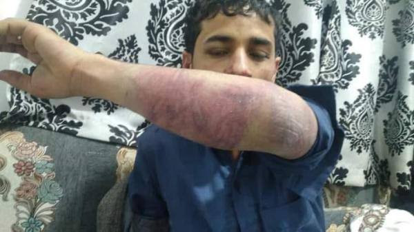 جريمة بشعة أحزنت جميع اليمنيين ..هذا ما حدث في العاصمة صنعاء هز الراي العام (شاهد)
