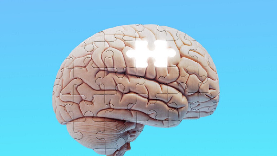 الدماغ