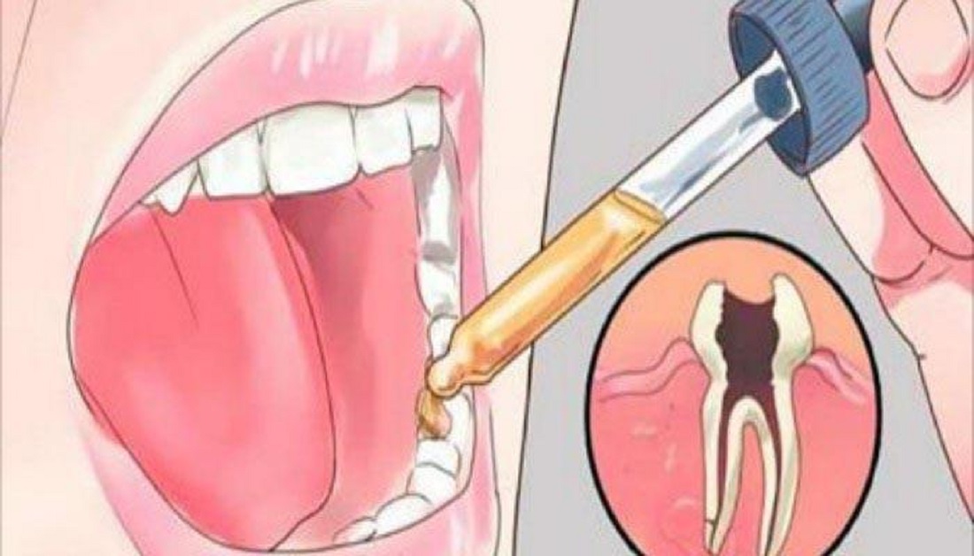 علاج الاسنان