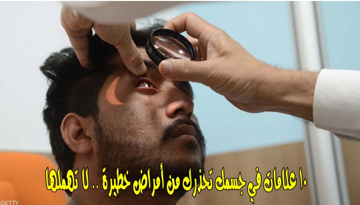 لا تهملها ..  10 علامات اذا ظهرت  في جسمك فانها تحذرك من أمراض خطيرة.. اذهب للطبيب فوراً؟ 