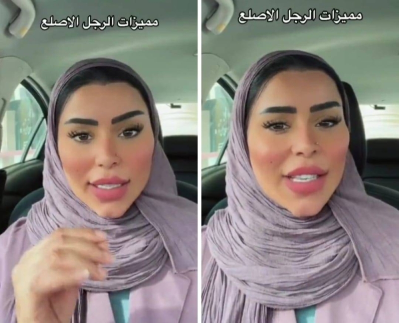 شخصية مهمة في الحياة.. شاهد مشهورة تيك توك سعودية تعدد مميزات الرجل الأصلع
