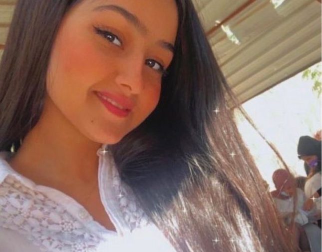 شاهد أول صورة صادمة لـ « الأميرة ريم » بعد أن شوه وجهها شاب مجنون بماء النار بسبب رفضها الزواج منه..  أصبحت كائن اخر؟ 