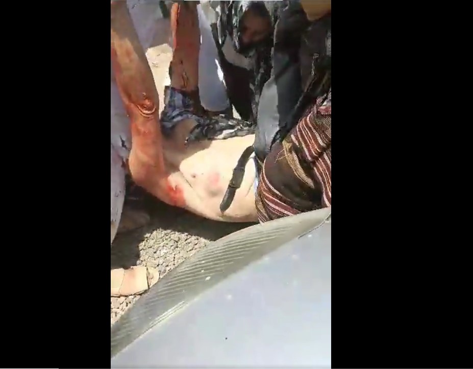اليمن : شاهد لحظة إغتيال المسؤول الأممي أمام مطعم الشيباني في مدينة التربة بتعز وانتشال جثته من قبل المواطنيين