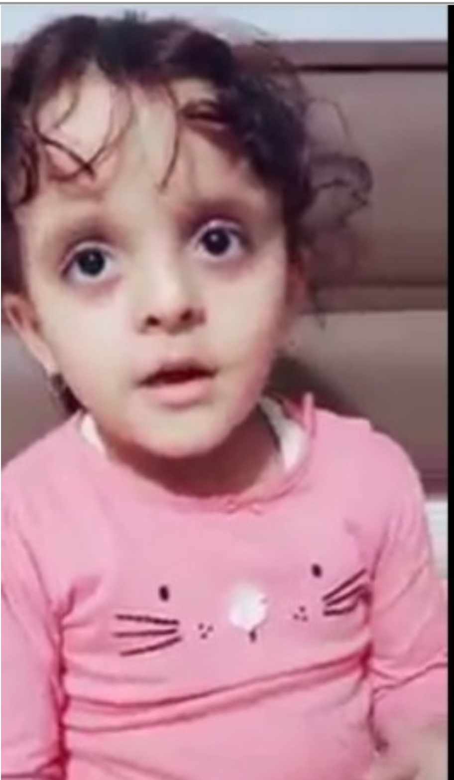 طفلة يمنية تخطف انظار العالم بهذه الموهبة النادرة والخارقة..شاهد