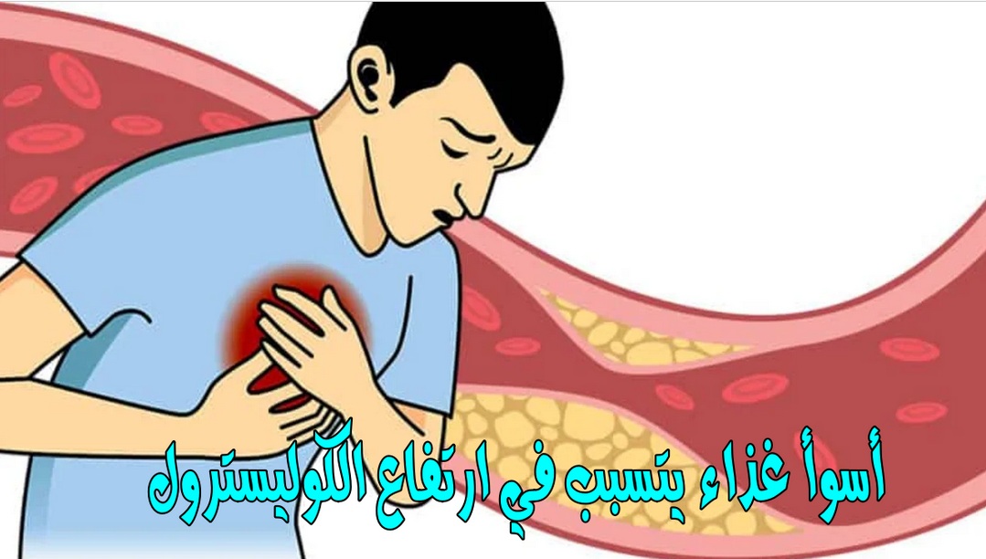 أسوأ غذاء يتسبب في ارتفاع الكوليسترول