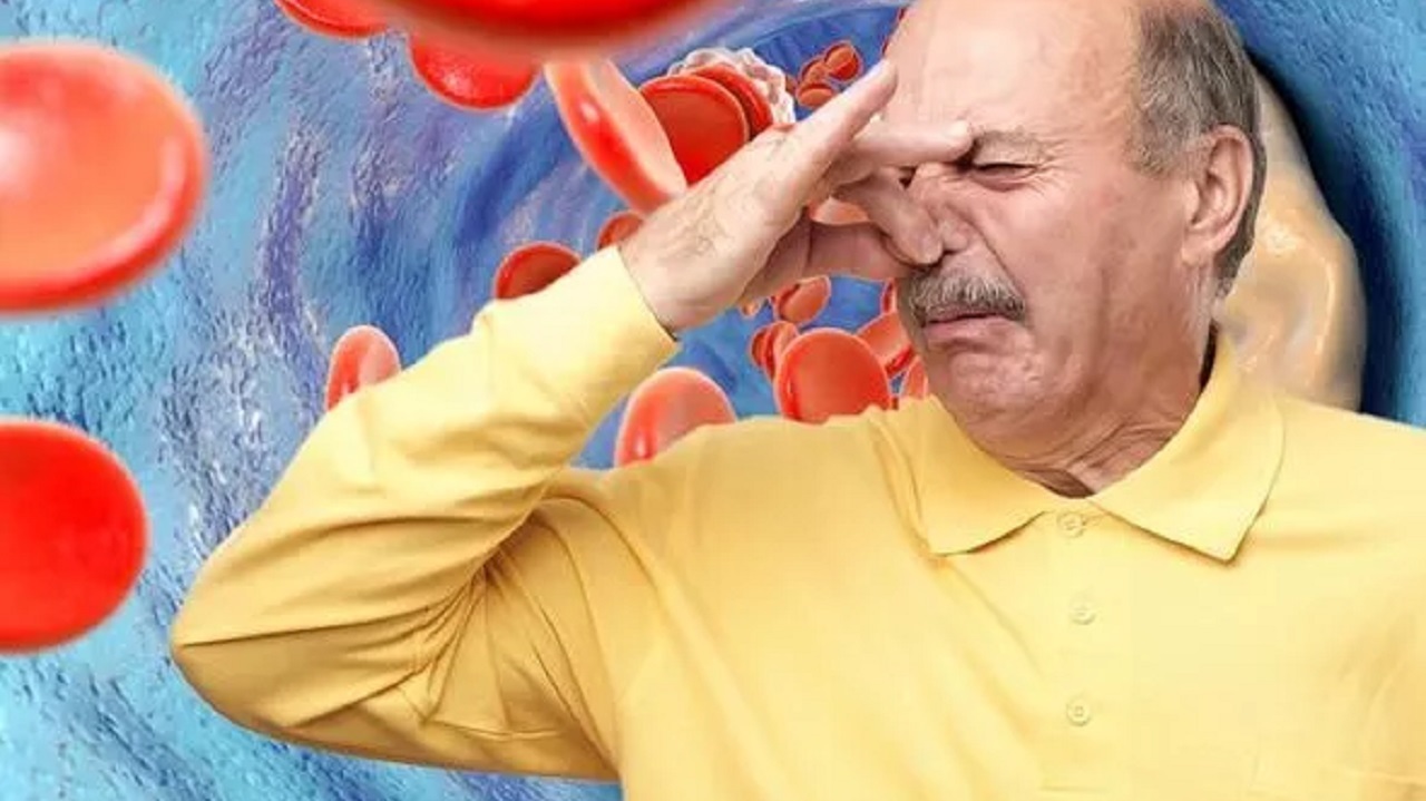 اعراض الكولسترول