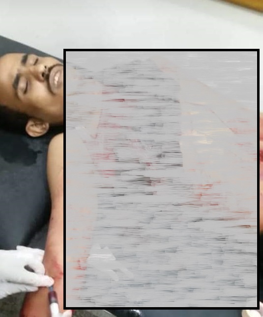 مقتل مغترب يمني بعد صراع مثير مع افعى طولها اربعة امتار حاولت تلتهمه وبفأس سعودي حاول انقاذه..شاهد الصور 