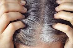 أفضل خلطات إزالة الشعر الأبيض باستخدام مكونات طبيعية تمامًا غير ضارة على فروة الرأس!