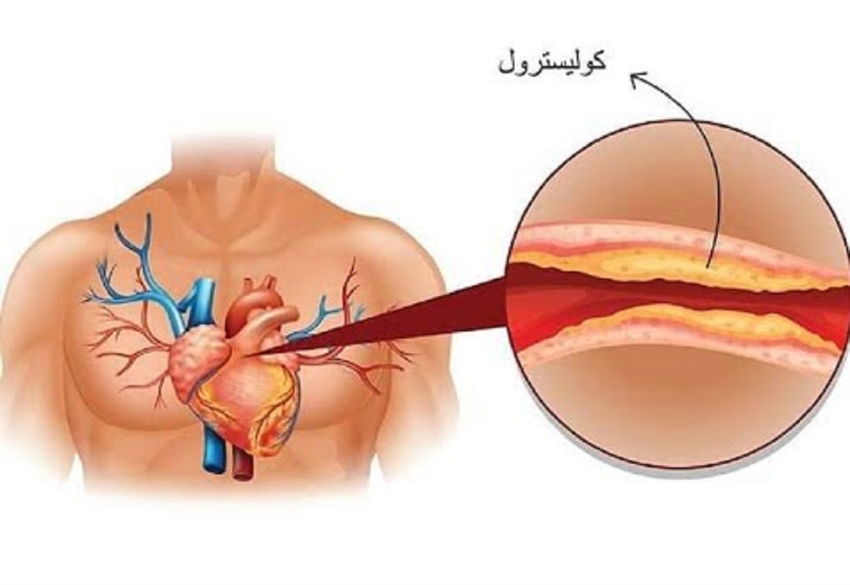 الكوليسترول 