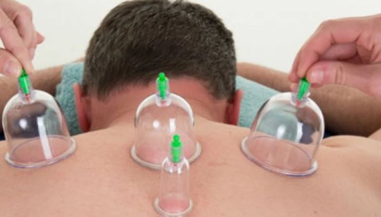 ماهي ال 8 فئات التي قد تواجه الموت بسبب الحجامة ؟!