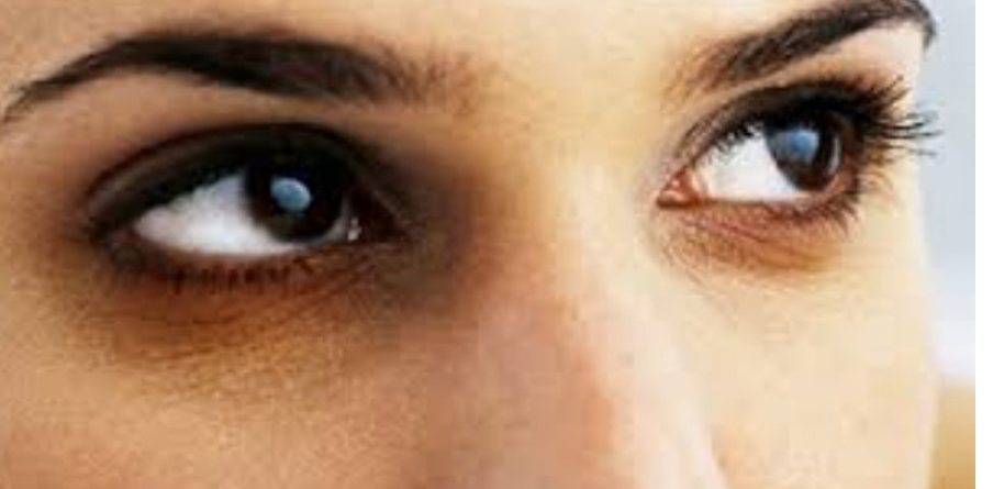 لا تهمل البقع العمياء لأنها قد تصيبك بالعمى الكلي