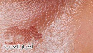 جلد الوجه
