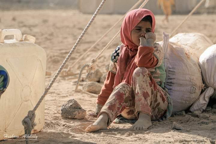 صور مؤلمة من نازحي الحرب في اليمن