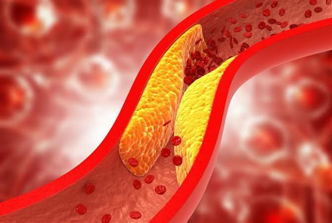 إحذر تناول اللحوم بهذه الطريقة ترفع الكوليسترول بشكل خطير للغاية!