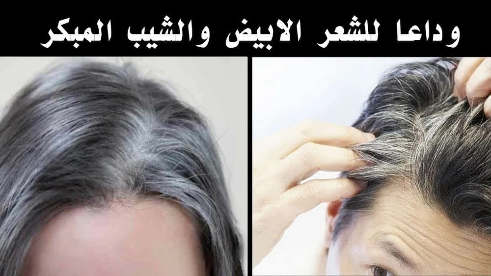 بدون حنة ولا صبغة..  وصفة سحرية للقضاء على الشيب نهائياً هترجعك عروسة تاني!.. وداعا للشيب المبكر