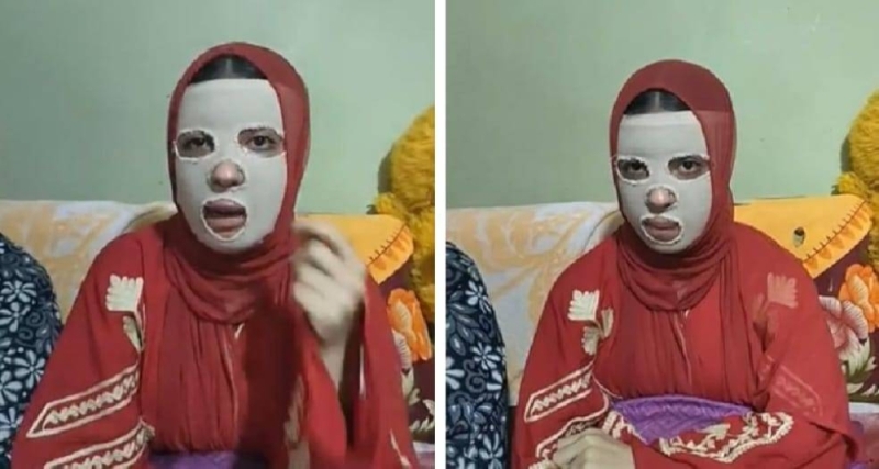 لا هتكوني لي ولا لغيري.. شاهد: شاب مصري ينتقم من فتاة جميلة لرفضها الارتباط به بحرق وجهها بماء فائر ..شاهد كيف كانت وكيف اصبحت