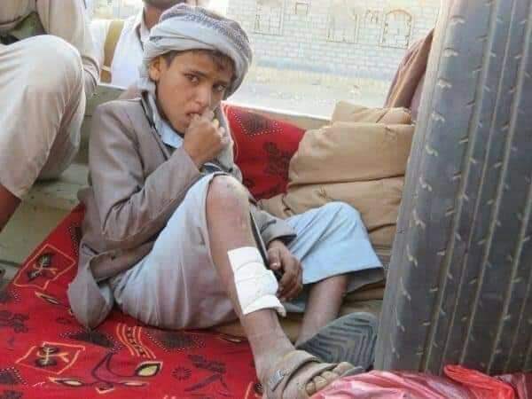 صورة لطفل يقاتل في صفوف الحوثيين في اليمن